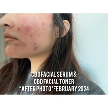 Load image into Gallery viewer, CBD Facial Toner with Vitamin C + Peptides
